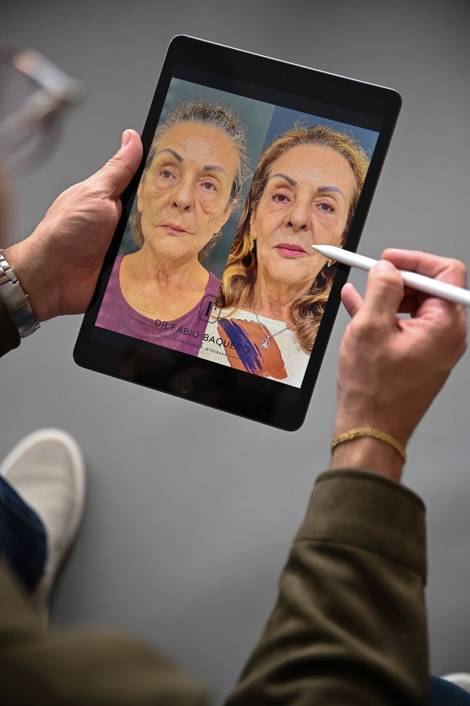 Dr. Fábio analisando em um tablet o antes e depois de uma paciente